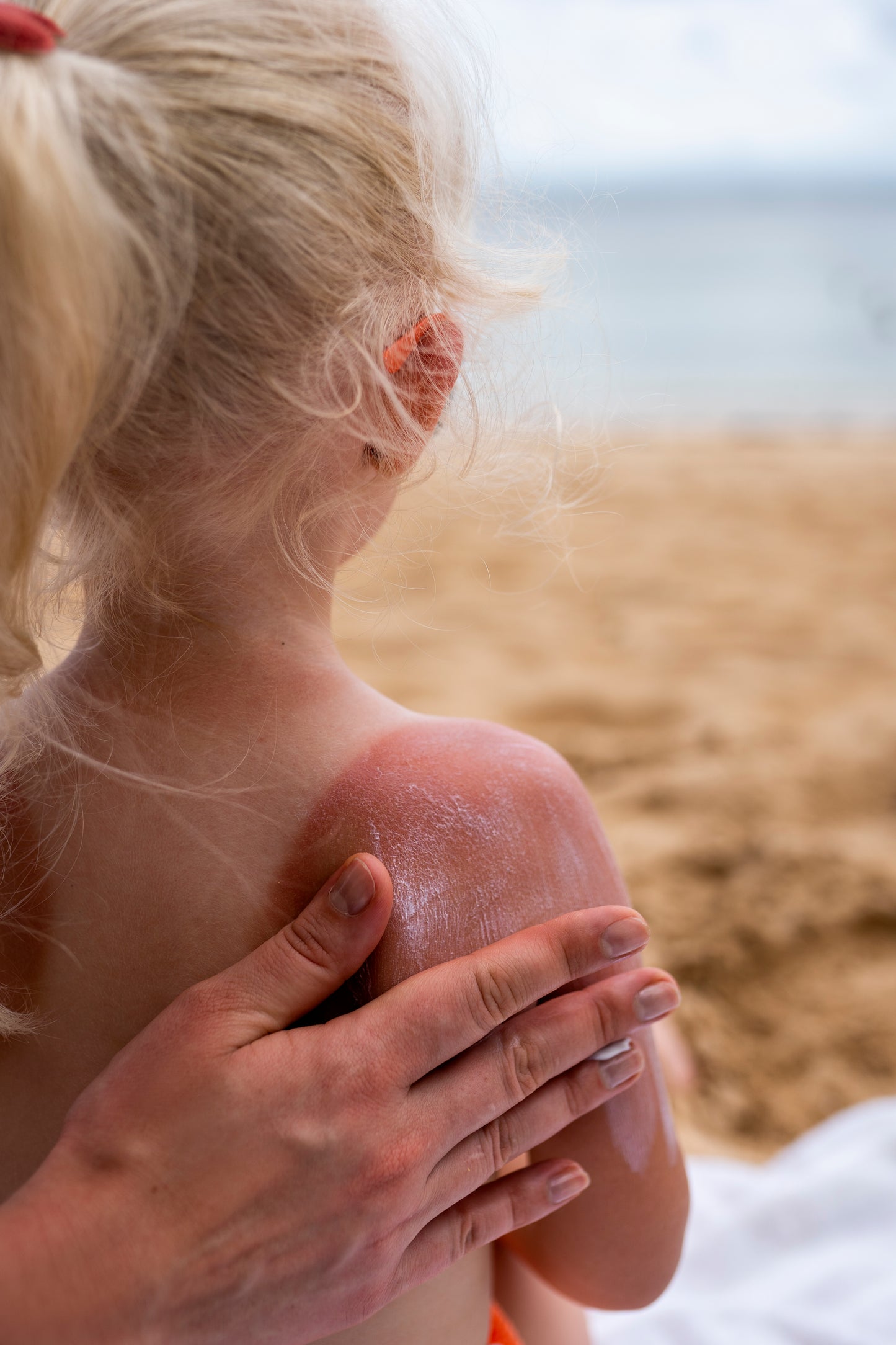 Skinify After Sun